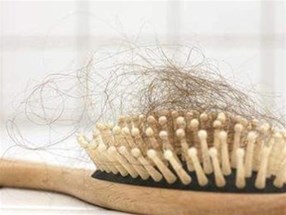 常見的脫發(fā)類型都有哪些？分別是什么癥狀？
