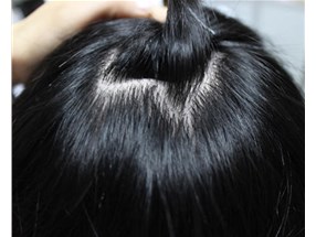 補發(fā)后，一般具有哪些特征呢？