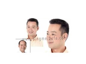 脫發(fā)人的中年危機(jī)只是偽命題 教你如何一招解決形象尷尬！