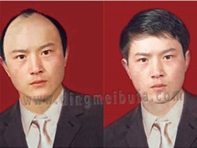 使用假發(fā)的禁忌有哪些？